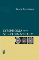 Lymphoma of the Nervous System артикул 4984a.