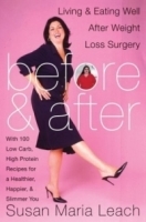 Before and After: Living and Eating Well After Weight Loss Surgery артикул 4816a.